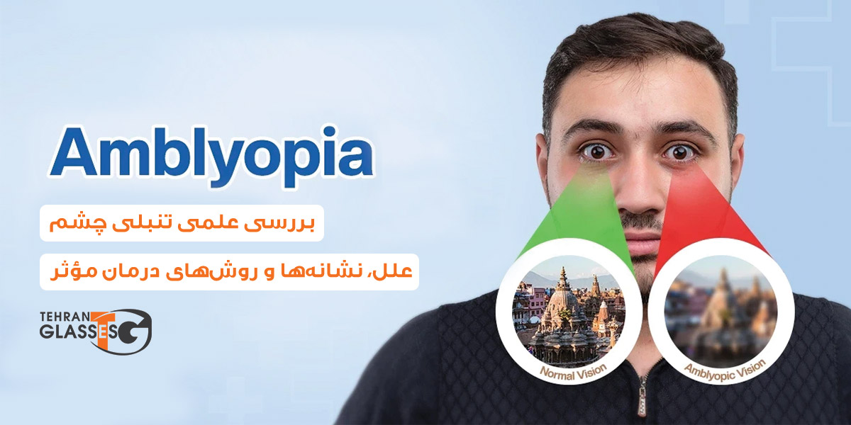 تنبلی چشم: علل، نشانهها و روشهای درمان مؤثر 6 عینک تهران فروشگاه عینک های اورجینال تنبلی چشم: علل، نشانهها و روشهای درمان مؤثر