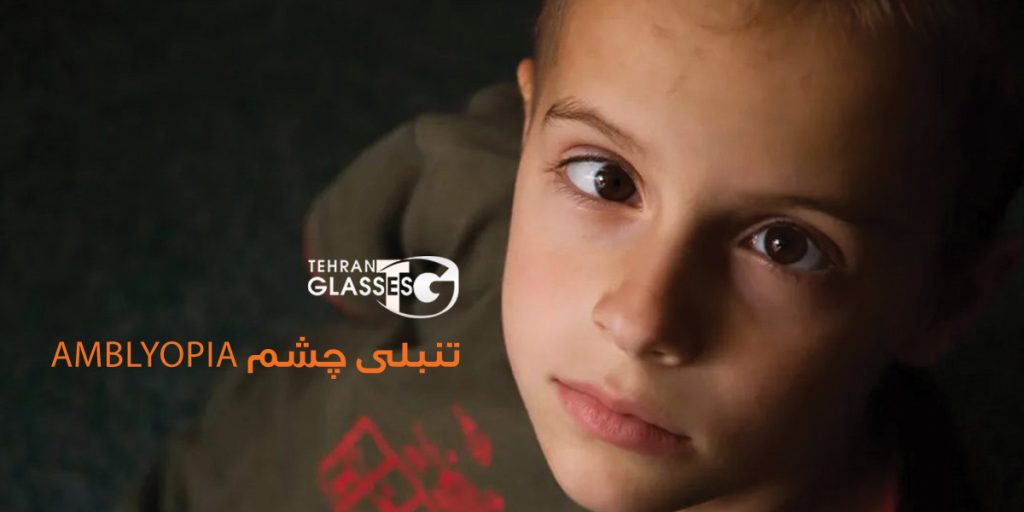تنبلی چشم: علل، نشانه‌ها و روش‌های درمان مؤثر