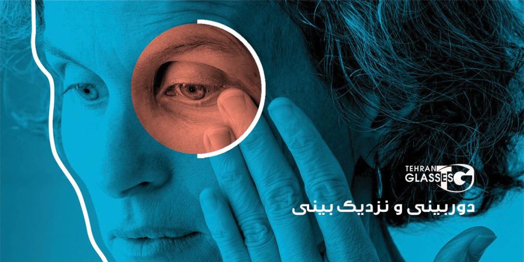 انحراف چشم (استرابیسم)