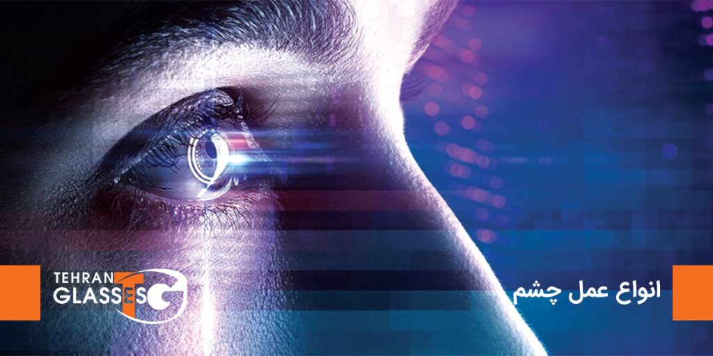 انواع عمل های جراحی چشم