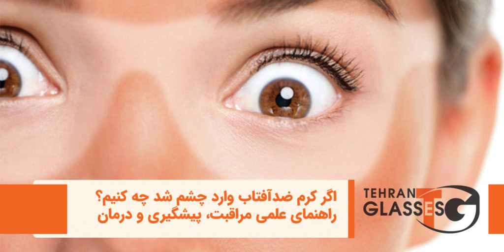 اگر کرم ضدآفتاب وارد چشم شد چه کنیم؟
